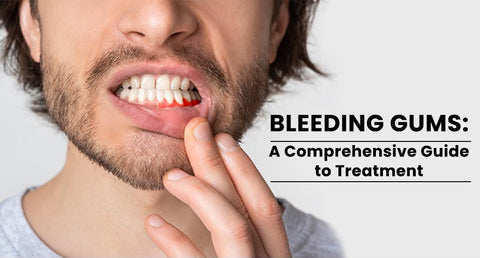 Bleeding Gums: A Comprehensive Guide to Treatment