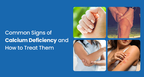 Low Calcium Symptoms: Common Signs of Calcium Deficiency and How to Treat Them